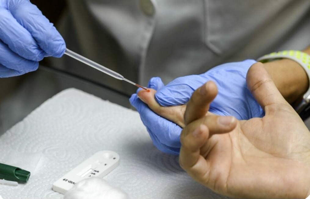 Número de novos casos de HIV em Goiânia tem queda de 10%